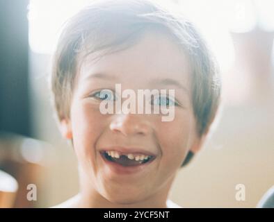 Junge mit einer Zahnlücke Stockfoto