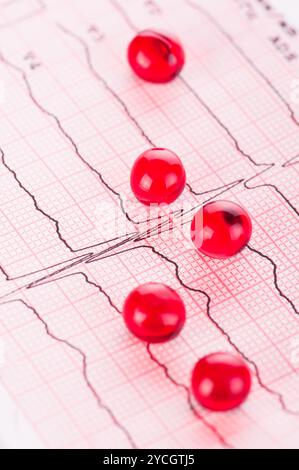 Kardiologie. Makro der ECG Graph und Cardio-Pillen Stockfoto