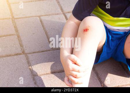 Die Wunde am Kindesbein. Fiel auf die Straße. Gebrochenes Knie. Gesundheit. Artikel über den Fall eines Kindes. Artikel über das Leckerli Stockfoto