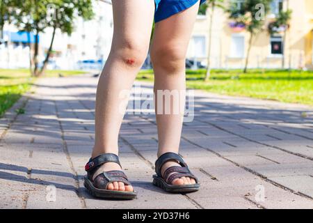 Die Wunde am Kindesbein. Fiel auf die Straße. Gebrochenes Knie. Gesundheit. Artikel über den Fall eines Kindes. Artikel über das Leckerli Stockfoto