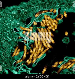 Kolorierte Transmissionselektronenmikrograph von Ebola-Virus-Partikeln (Gold) fand sowohl extrazellulär als auch Knospen von chronisch infizierten Afrikanern. Stockfoto