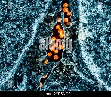 Kolorierter Transmissionselektronenmikrograph von HIV-1-Viruspartikeln (orange), die aus einer H9-T-Zelle (Petrol) herauswachsen und replizieren. Stockfoto