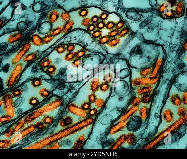 Kolorierte Transmissionselektronenmikrographie von Viruspartikeln der Aviären Influenza A H5N1 (orange). Stockfoto