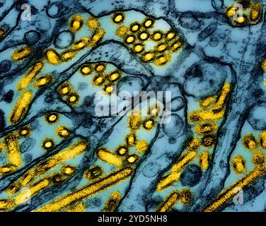 Kolorierte Transmissionselektronenmikrographie von Viruspartikeln der Aviären Influenza A H5N1 (gelb). Stockfoto