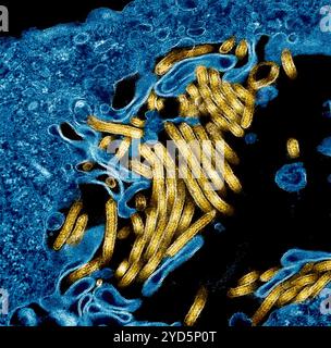 Kolorierte Transmissionselektronenmikrograph von Ebola-Virus-Partikeln (Gold) fand sowohl extrazellulär als auch Knospen von chronisch infizierten Afrikanern. Stockfoto