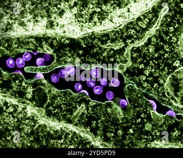 Koloriertes Transmissionselektronenmikroskop von HIV-1-Viruspartikeln (violett), die aus einer H9-T-Zelle (grün) herauswachsen und replizieren. Stockfoto