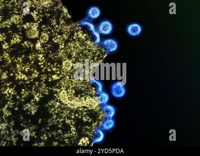 Transmissionselektronenmikroskop von HIV-1-Viruspartikeln (blau), die aus der Plasmamembran einer H9-T-Zelle (grün) replizieren. Stockfoto