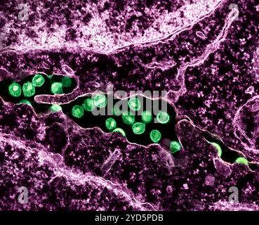 Kolorierte Transmissionselektronenmikroskopie von HIV-1-Viruspartikeln (grün), die aus einer H9-T-Zelle (Burgunderrot) herauswachsen und replizieren. Stockfoto