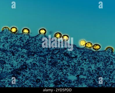 Kolorierter Transmissionselektronenmikrograph von HIV-1-Viruspartikeln (gelb), die aus einer H9-T-Zelle (dunkelblau) herauswachsen und replizieren. Stockfoto