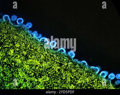 Kolorierter Transmissionselektronenmikrograph von HIV-1-Viruspartikeln (blau), die aus einer H9-T-Zelle (hellgrün) herauswachsen und replizieren. Stockfoto