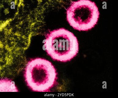 Transmissionselektronenmikrogramm von HIV-1-Viruspartikeln (pink), die sich aus der Plasmamembran einer H9-T-Zelle replizieren. Stockfoto