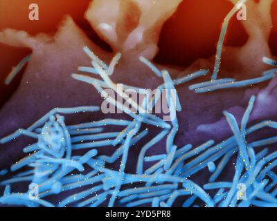 Rasterelektronenmikrogramm humaner respiratorischer Synzytialviren (RSV) (blau gefärbt), die mit Anti-RSV F Protein/Gold markiert sind. Stockfoto