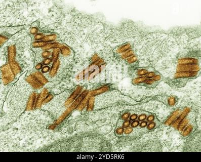 Kolorierte Transmissionselektronenmikrographie von Tollwutviruspartikeln (gelb). Stockfoto