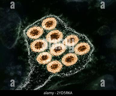 Kolorierte Transmissionselektronenmikrographie von Tollwutviruspartikeln (orange). Stockfoto
