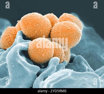 Ein farbiges rasterelektronenmikroskopisches Bild von Streptokokken der Gruppe A (orange) während phagozytischer Interaktion mit einem humanen Neutrophilen (Petrol). Stockfoto