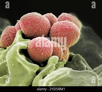 Ein farbiges rasterelektronenmikroskopisches Bild von Streptokokken der Gruppe A (orange) während phagozytischer Interaktion mit einem humanen Neutrophilen (Petrol). Stockfoto