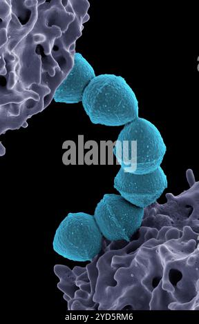 Colorierte Rasterelektronenmikroskopie von Streptokokken der Gruppe A (Streptococcus pyogenes) Bakterien (Petrol) und einer humanen Neutrophile (Purple). Stockfoto