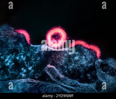Transmissionselektronenmikrogramm von HIV-1-Viruspartikeln mit rosa Färbung, die aus einer HIV-infizierten H9-T-Zelle blau/violett repliziert wird. Knospende Viruspartikel, die sich noch nicht von der Zelle getrennt haben, erscheinen als Halbkreise. In der Bildmitte ist ein abgetrenntes, sphärisches, unreifes Partikel zu sehen. HIV-1 Viruspartikel 016867 031 Stockfoto