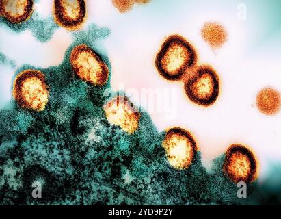 Transmissionselektronenmikrogramm von HIV-1-Viruspartikeln, die orange/gelb gefärbt sind und sich aus einem HIV-infizierten H9-T-Zell-Grün replizieren. HIV-1 Viruspartikel 016867 036 Stockfoto