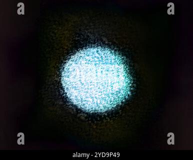 Koloriertes Transmissionselektronenmikroskop eines Hepatitis-C-Virions. Hepatitis C 016867 053 Stockfoto