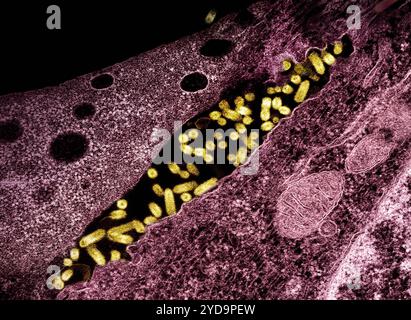 Transmissions-Elektronenmikroskop zeigt VSV-Partikel des vesikulären Stomatitis-Virus gelb, die aus infizierten Zellen burgundy wachsen. Vesikuläre Stomatitis Virus VSV 016867 075 Stockfoto