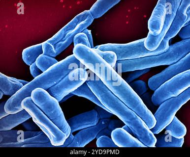 Rasterelektronenmikroskopische Darstellung von Mycobacterium tuberculosis-Partikeln, die blau gefärbt sind, das Bakterium, das TB verursacht. Mycobacterium Tuberculosis-Bakterien 016867 100 Stockfoto