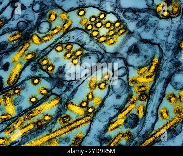 Kolorierter Transmissionselektronenmikrograph der aviären Influenza A H5N1-Viruspartikel gelb, gezüchtet in Madin-Darby-Canine Niere MDCK Epithelzellen blau. Vogelgrippe A Virus H5N1/Vogelgrippe 016867 136 Stockfoto