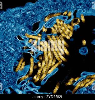 Kolorierter Transmissions-Elektronenmikrograph von Ebola-Virus-Partikeln Gold fand sowohl extrazellulär und Knospen von chronisch infizierten afrikanischen grünen Affen Nierenzellen blau. 2024 : Experimentelle Ebola-Impfstoffe fanden sicher und in der Lage, Immunantworten bei gesunden Erwachsenen zu produzieren. Ebola Virus Partikel 016867 187 Stockfoto