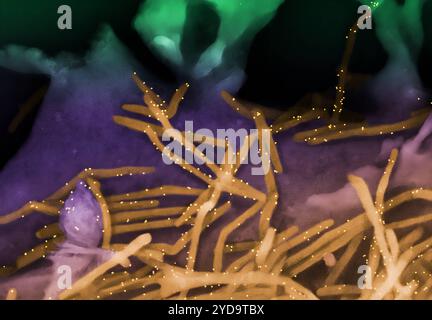 Rasterelektronenmikroskopische Darstellung des humanen respiratorischen Synzytialvirus RSV, gefärbt in Halloween-geeigneten Farben. Virionfarbiges Gold wird mit gelb gefärbten Anti-RSV-F-Protein-/Gold-Antikörpern markiert, die von der Oberfläche humaner Lungenepithelzellen A549 ausscheiden. RSV ist ein häufiges ansteckendes Virus, das die menschlichen Atemwege infiziert. Humanes Respiratory Syncytial Virus RSV 016867 293 Stockfoto