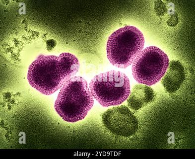 Kolorierter Transmissionselektronenmikrograph von Influenza A/H3N2 Viruspartikeln rosa, isoliert aus einer Patientenprobe und anschließend in Zellkultur vermehrt. Influenza A kann sowohl Mensch als auch Tier, einschließlich Vögel und Schweine, infizieren. Influenza-A-Virus H3N2 016867 309 Stockfoto