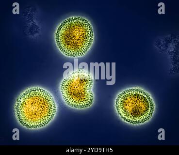 Influenza-B-Viruspartikel, gelb und grün gefärbt, aus einer Patientenprobe isoliert und dann in Zellkultur vermehrt. Sowohl Influenza A als auch B können saisonale Grippe verursachen, im Gegensatz zum Influenza A-Virus, das auch Tiere infizieren kann, infiziert Influenza B nur den Menschen. Influenza-B-Virus 016867 319 Stockfoto