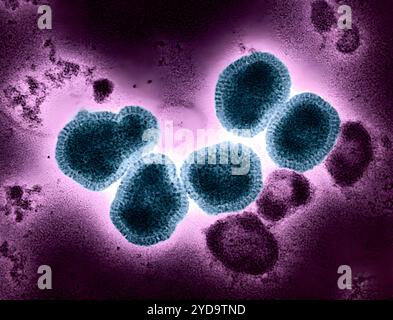 Kolorierter Transmissionselektronenmikrograph von Influenza A/H3N2 Viruspartikeln Petrol, isoliert aus einer Patientenprobe und dann in Zellkultur vermehrt. Influenza A kann sowohl Mensch als auch Tier, einschließlich Vögel und Schweine, infizieren. Influenza-A-Virus H3N2 016867 308 Stockfoto