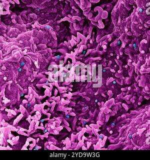 Gefärbtes Rasterelektronenmikroskop von Mpockenviruspartikeln blau auf der Oberfläche infizierter VERO E6-Zellen pink. Mpox Virus 016867 375 Stockfoto