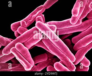 Rasterelektronenmikroskopische Darstellung von Mycobacterium tuberculosis-Partikeln, die rosa gefärbt sind, das TB-verursachende Bakterium. Mycobacterium Tuberculosis-Bakterien 016867 395 Stockfoto