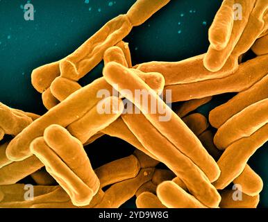 Rasterelektronenmikroskopische Darstellung von Mycobacterium tuberculosis-Partikeln färbte Gold, das TB-verursachende Bakterium. Mycobacterium Tuberculosis-Bakterien 016867 398 Stockfoto