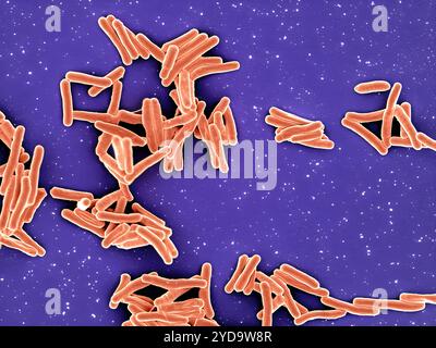 Rasterelektronenmikroskopische Darstellung von Mycobacterium tuberculosis-Partikeln, die orange gefärbt sind, das TB-verursachende Bakterium. Mycobacterium Tuberculosis-Bakterien 016867 396 Stockfoto