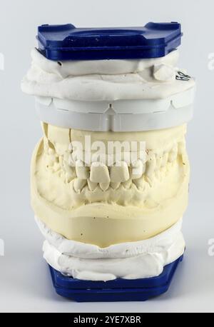 Vertikales Dentalmodell in blau und weiß, zeigt Ober- und Unterkiefer aus Gips im Detail Stockfoto