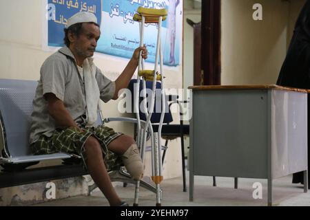 Amputierte erhalten in einem Krankenhaus in der jemenitischen Stadt Taiz Prothesen an den Gliedmaßen Stockfoto