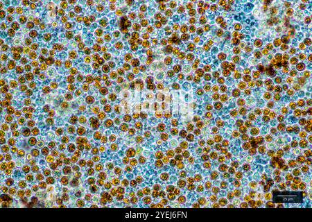 Symbiotische Algen (Zooxanthellen, Cladocopium sp.) Extrahiert aus der Weichkoralle Capnella imbricata (Alcyonacea, Nephtheidae). Stockfoto