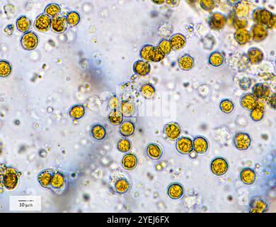 Symbiotische Algen (Zooxanthellen, Cladocopium sp. og Symbiodinium sp.) Extrahiert aus einem gelben Zoanthid (Zoanthidea, Parazoanthus sp.?) Vom Indo-Pa Stockfoto