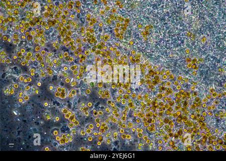 Symbiotische Algen (Zooxanthellen), extrahiert aus einem gelben Zoanthid (Zoanthidea, Parazoanthus sp.?) Vom Indo-Pazifik. Stockfoto