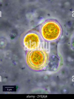 Symbiotische Algen (Zooxanthellen), extrahiert aus einem gelben Zoanthid (Zoanthidea, Parazoanthus sp.?) Vom Indo-Pazifik. Stockfoto