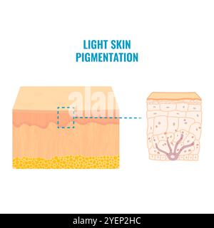 Heller Hautton Pigmentmechanismus medizinisch Stock Vektor