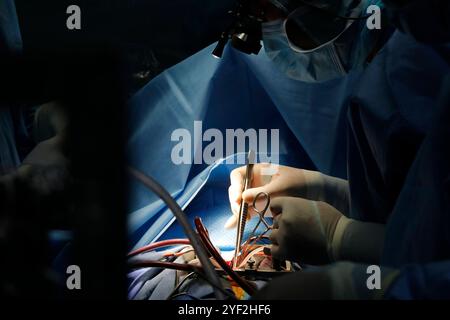 Kardiologisches Krankenhaus. Operationssaal. Herzchirurgie. Ho-Chi-Minh-Stadt. Vietnam. Kardiologiekrankenhaus 016798 118 Stockfoto