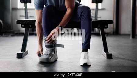 Gebrochene Fussbeinverletzung. Knochenfrakturbehandlung Stockfoto