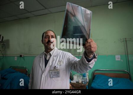 Dr. Azim Samim untersucht im Februar in einem Krankenhaus in der Hauptstadt Kabul, Afghanistan, eine Röntgenaufnahme der Brust eines Patienten mit Lungenentzündung Stockfoto