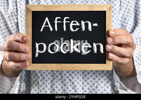 Bayern, Deutschland - 12. November 2024: Affenpocken, kranker Patient im Patientenkleid mit Schild. Symbolisches Bild für Pocken, oder Pocken Krankheit - Mpocken und Krankheit, sowie Symptome. *** Affenpocken, Erkrankter Patient im Patientenkittel mit Schild. Symbolbild für Pocken, bzw. Pocken-Erkrankung - Mpox und Krankheit, sowie Symptome. Stockfoto