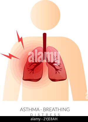 Asthma – Lungen mit Atemnot – Stock Illustration als EPS 10 Datei Stock Vektor