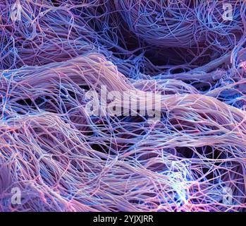 Bindegewebe. Farbige Rasterelektronenmikrographie (REM) von Kollagen aus einer nasalen Polybiopsie. Kollagen ist ein Protein mit hoher Zugfestigkeit, das Epithel, Sehnen, Bändern und Knochen Struktur und Elastizität verleiht. Es ist das am häufigsten vorkommende Protein im Körper. In der Dermis bildet Kollagen seilähnliche Fasern, die unregelmäßig angeordnet sind. Vergrößerung: x1300, wenn 10 Zentimeter breit gedruckt. Stockfoto