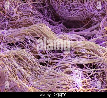 Bindegewebe. Farbige Rasterelektronenmikrographie (REM) von Kollagen aus einer nasalen Polybiopsie. Kollagen ist ein Protein mit hoher Zugfestigkeit, das Epithel, Sehnen, Bändern und Knochen Struktur und Elastizität verleiht. Es ist das am häufigsten vorkommende Protein im Körper. In der Dermis bildet Kollagen seilähnliche Fasern, die unregelmäßig angeordnet sind. Vergrößerung: x1300, wenn 10 Zentimeter breit gedruckt. Stockfoto